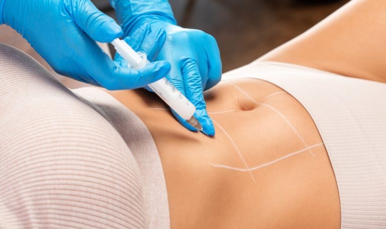 Zabiegi wspomagające pielęgnację skóry po ciąży