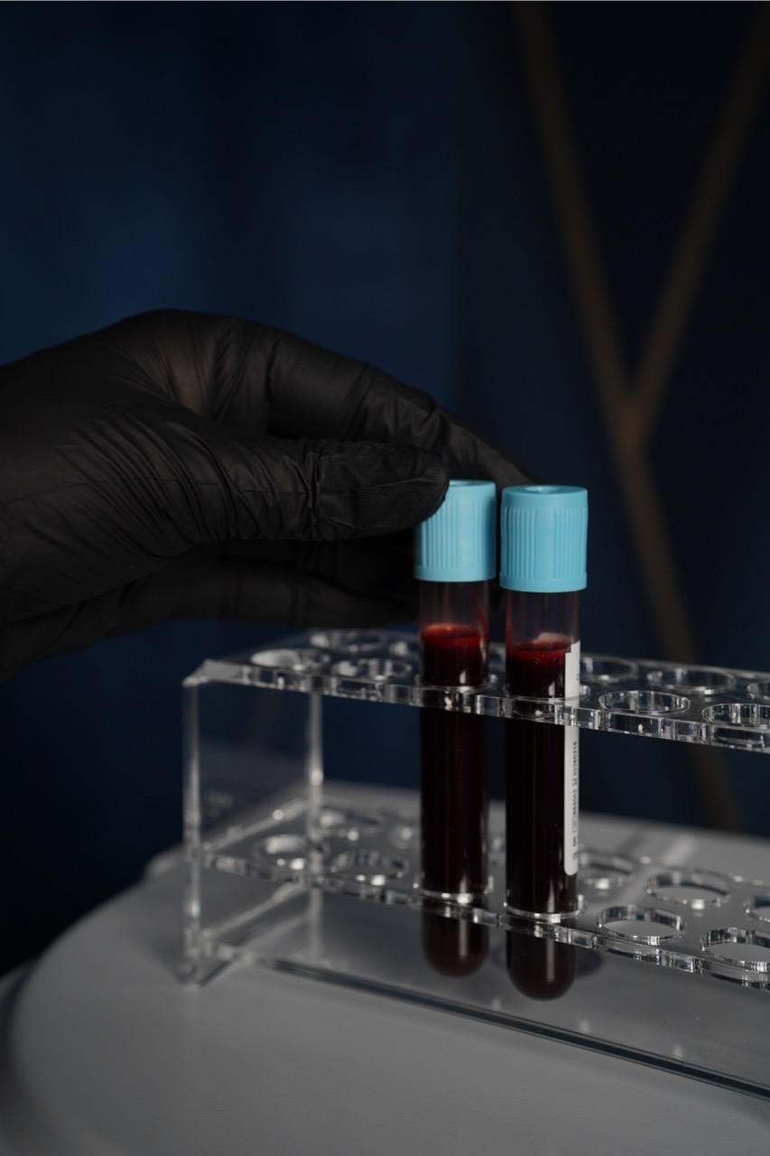 zabiegi z osoczem rybnik