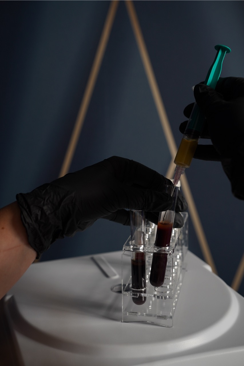 osocze bogatopłytkowe w kosmetologii