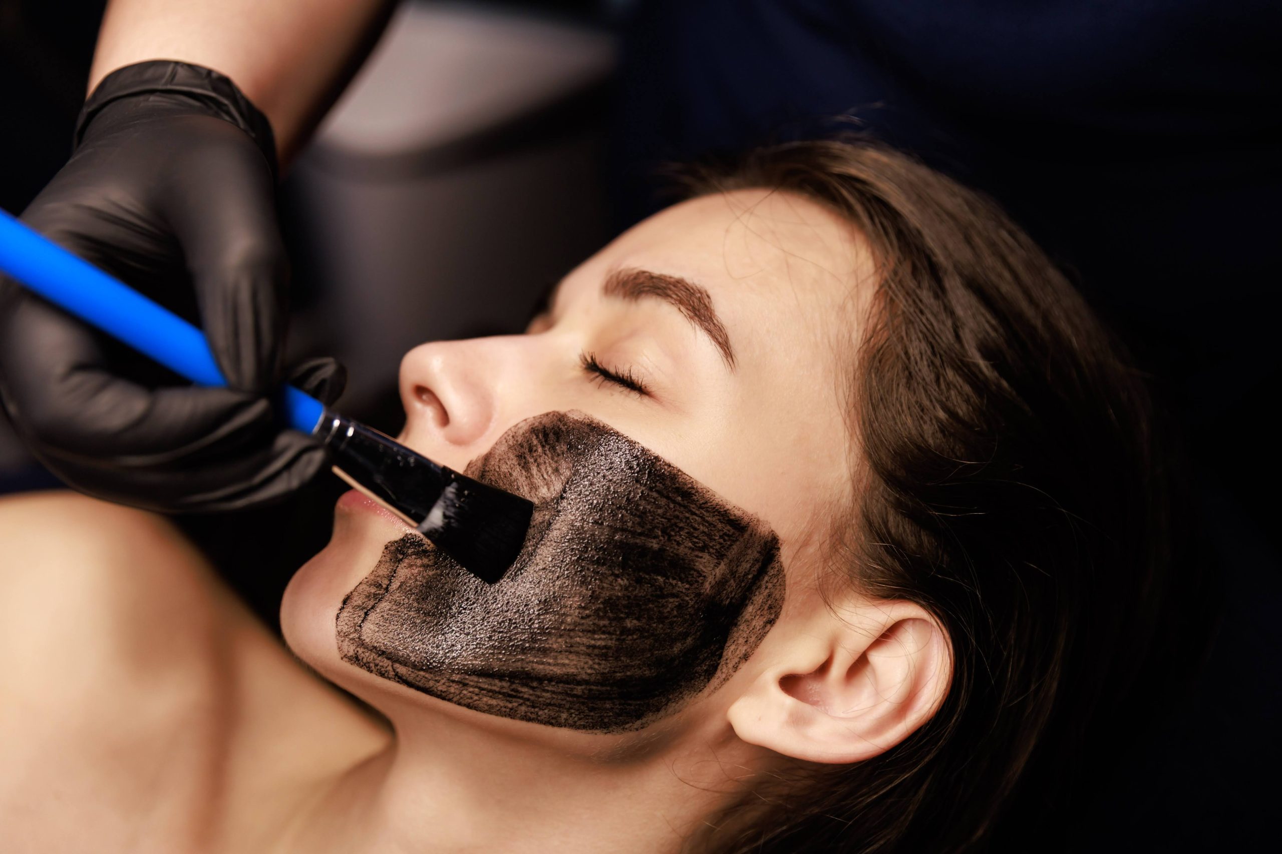 laserowy peeling węglowy rybnik