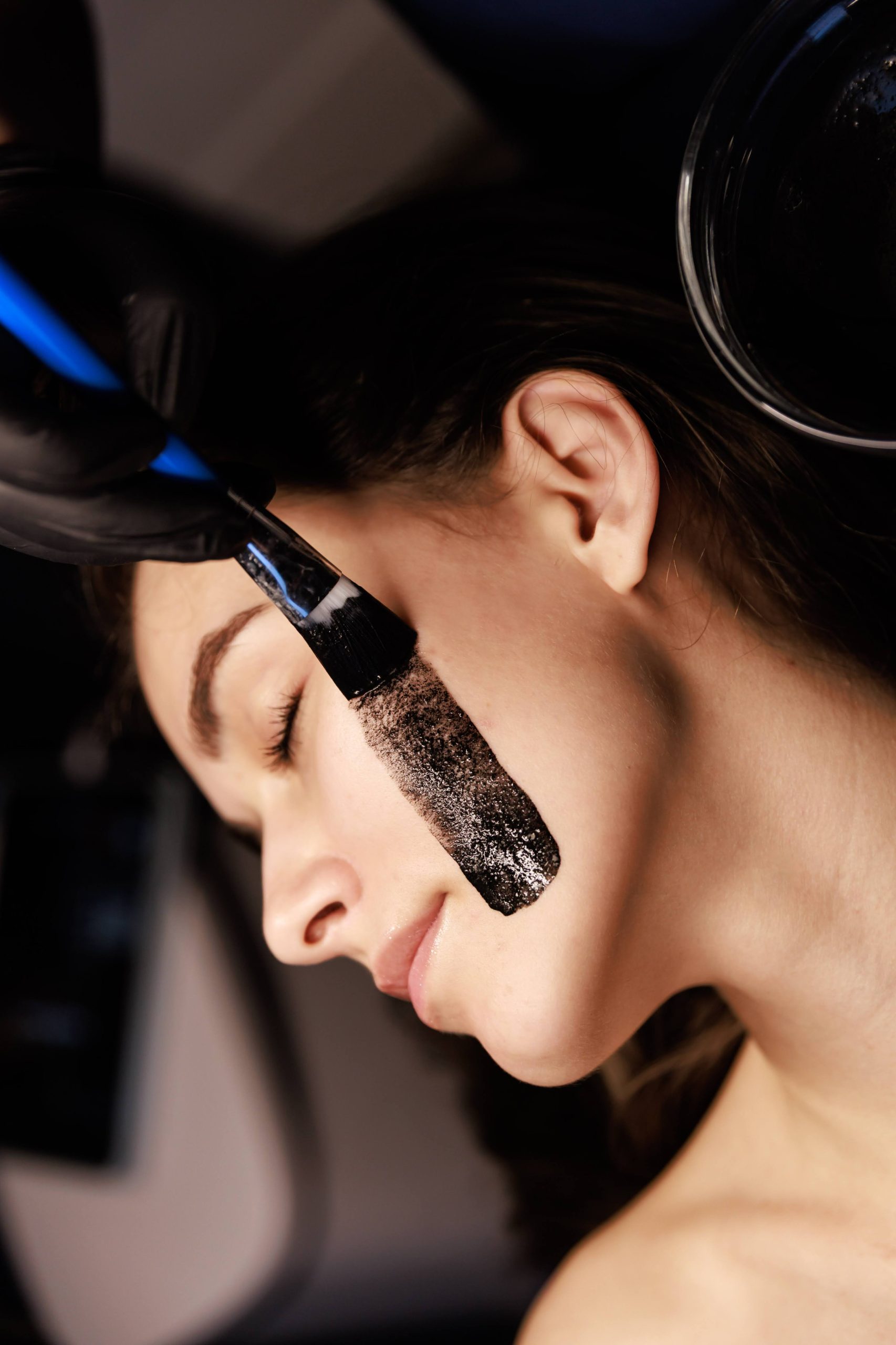 peeling węglowy laserowy rybnik